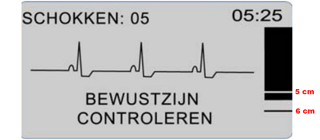 ZOLL AED PLUS rescuer ECG-weergave