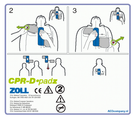 toelichting plaatsing ZOLL CPR-D padz